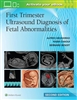 First Trimester Ultrasound Diagnosis of FetalAbnormalities, 2nd ed.