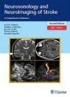 Neurosonology & Neuroimaging of Stroke, 2nd ed.- A Comprehensive Reference