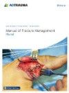 Manual of Fracture Management: Hand