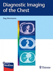 Diagnostic Imaging of Chest