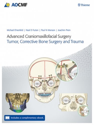 Advanced Craniomaxillofacial SurgeryTumor, Corrective Bone Surgery, & Trauma