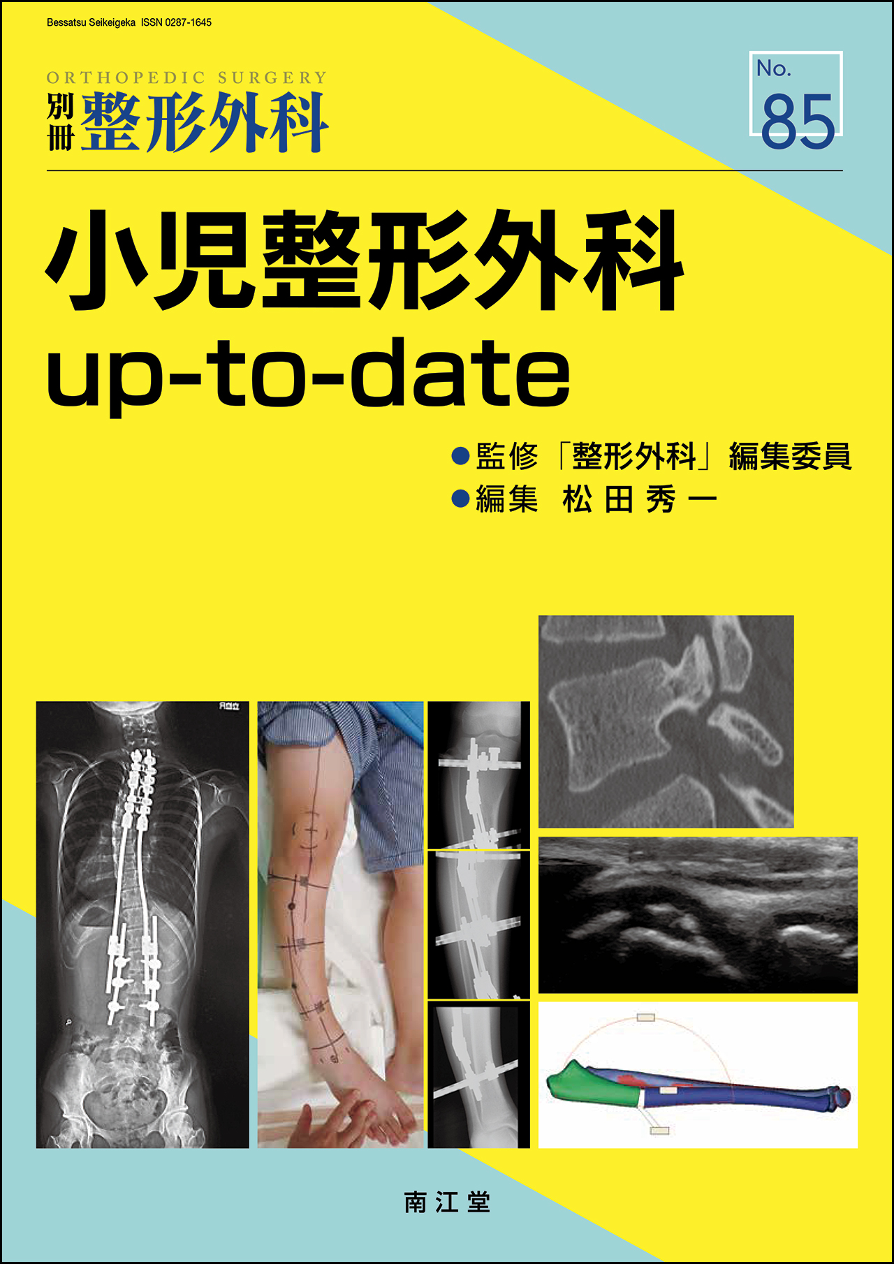 No.85 小児整形外科up-to-date: 雑誌／南江堂