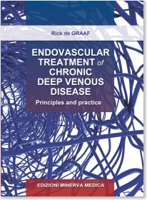 Endovascular Treatment of Chronic Deep Venous DiseasePrinciples & Practice