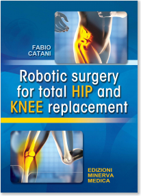 Robotic Surgery for Total Hip & Knee Replacement