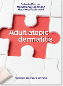 Adult Atopic Dermatitis