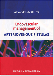Endovascular Management of Arteriovenous Fistulas