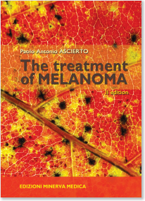 Treatment of Melanoma