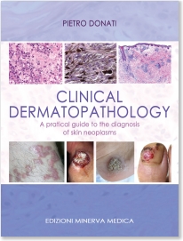 Clinical DermatopathologyPratical Guide to Diagnosis of Skin Neoplasms
