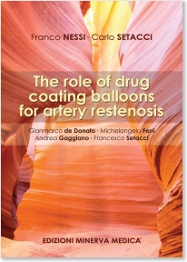 Role of Drug Coating Balloons for Artery Restenosis