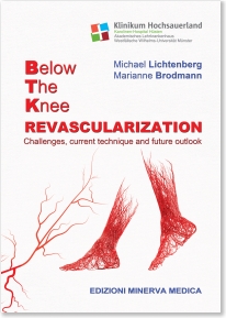 Below Knee RevascularizationChallenges, Current Technique & Future Outlook