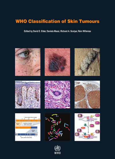 WHO Classification of Skin Tumours, 4th ed.(WHO Classification of Tumours, Vol.11)