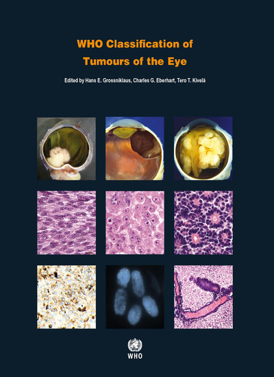 WHO Classification of Tumours of the Eye, 4th ed.(WHO Classification of Tumours, Vol.12)