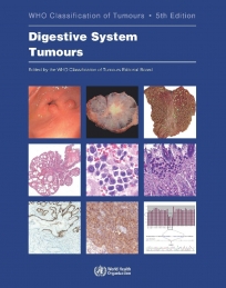 WHO Classification of Tumours, 5th ed., Vol.1Digestive System Tumours