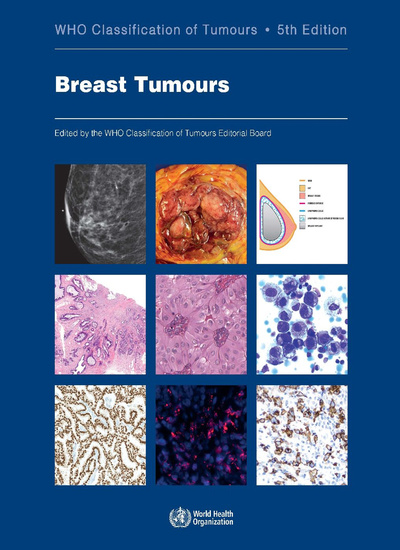 WHO Classification of Tumours, 5th ed., Vol.2Breast Tumours