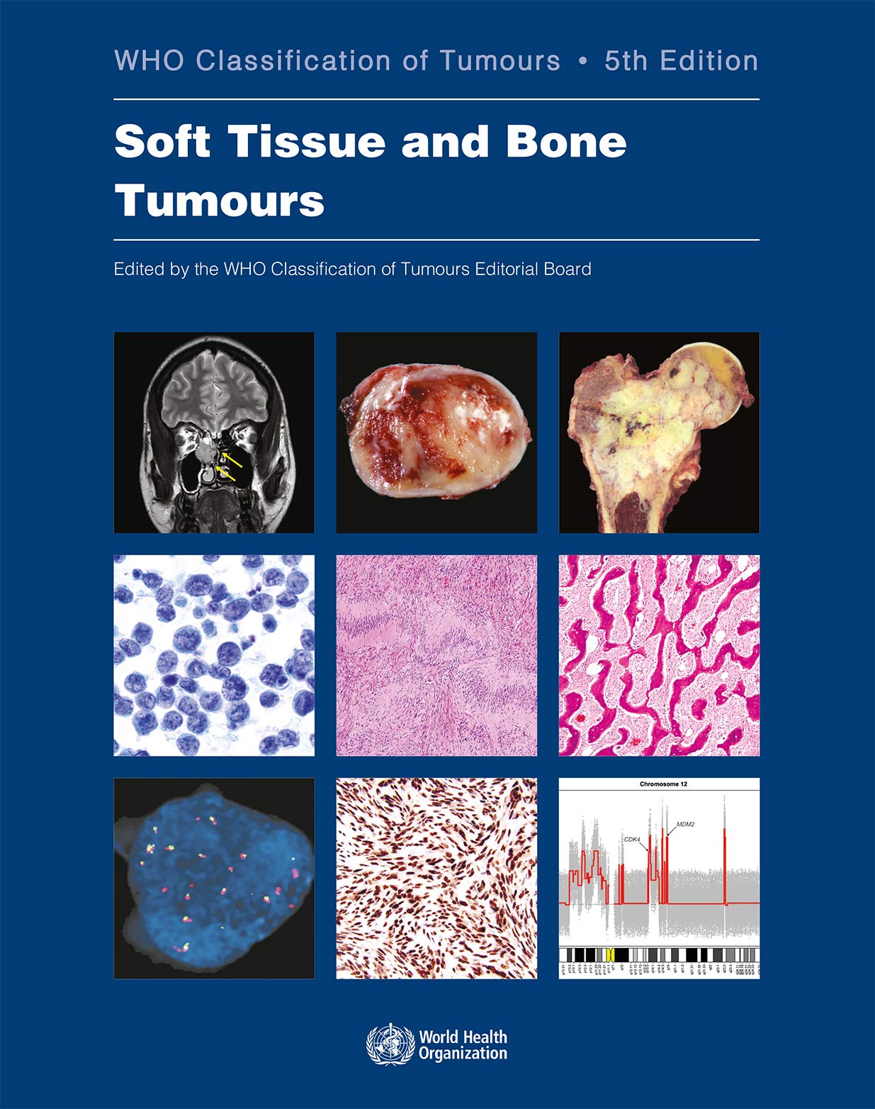 WHO Classification of Tumours, 5th ed., Vol.3Soft Tissue & Bone Tumours