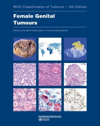 WHO Classification of Tumours, 5th ed., Vol.4Female Genital Tumours