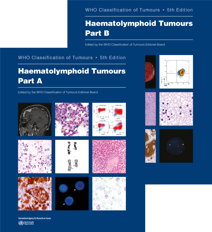 WHO Classification of Tumours, 5th ed., Vol.11In 2 vols.