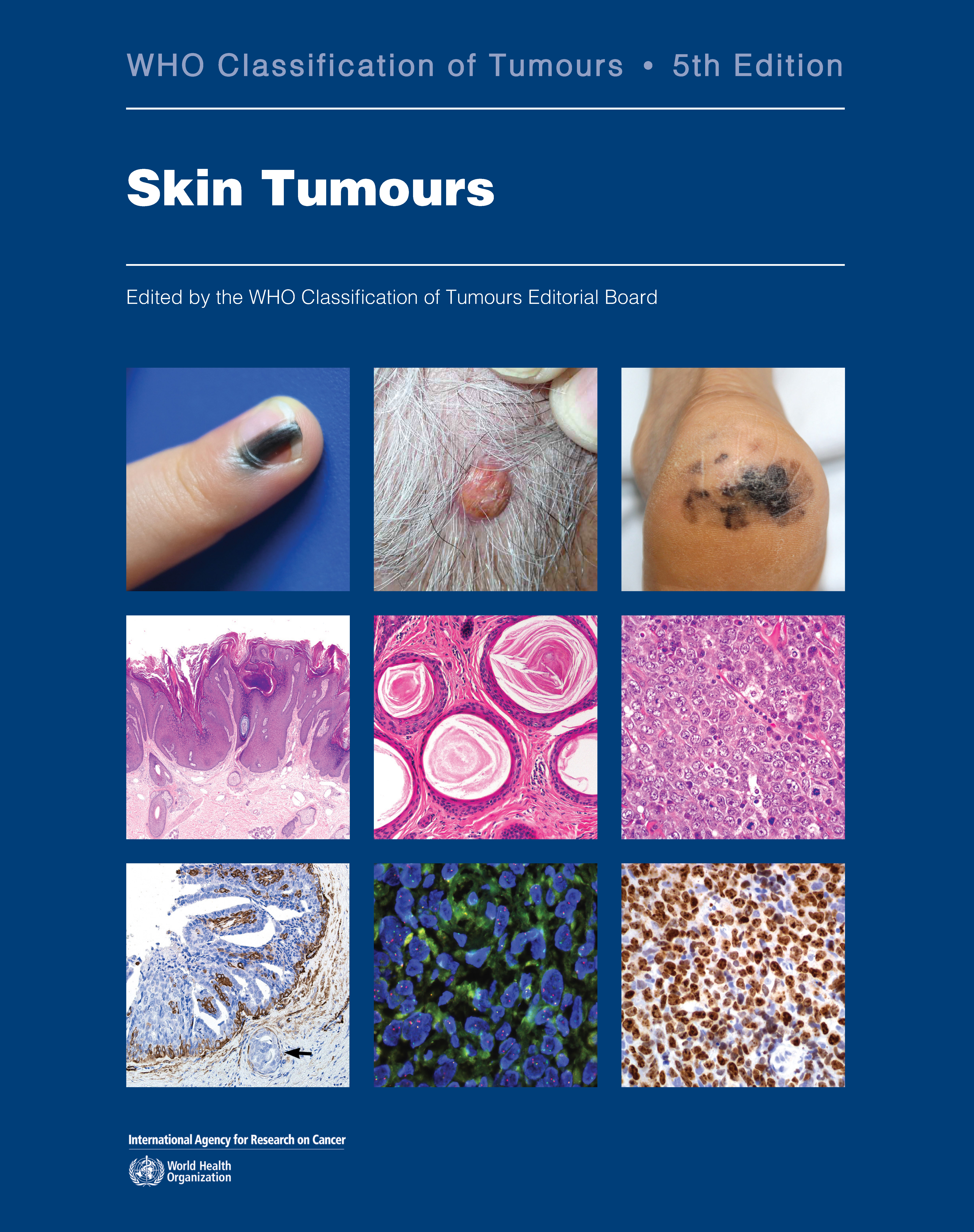 WHO Classification of Tumours, 5th ed., Vol.12Skin Tumours