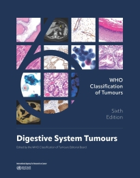 WHO Classification of Tumours, 6th ed., Vol.1Digestive System Tumours