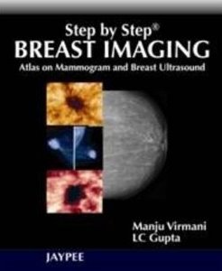 Step by Step- Breast Imaging