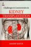 Challenges & Controversies in Kidney Transplantation
