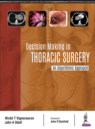 Decision Making in Thoracic Surgery- An Algorithmic Approach