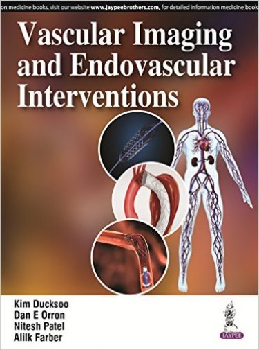 Vascular Imaging & Endovascular Interventions