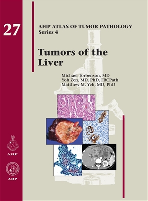 Atlas of Tumor Pathology, 4th Series, Fascicle 27- Tumors of the Liver