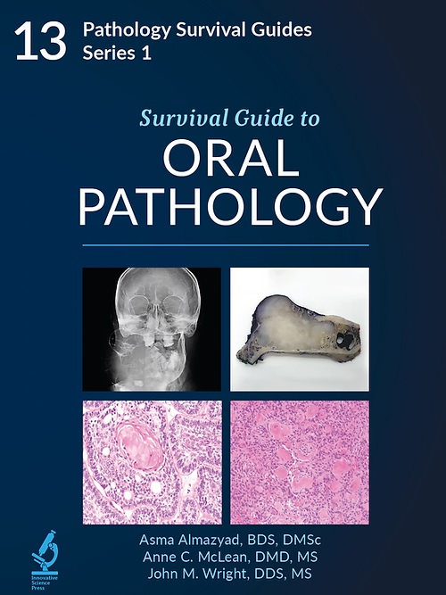 Pathology Survival Guides, Series 1Vol.13: Survival Guide to Oral Pathology