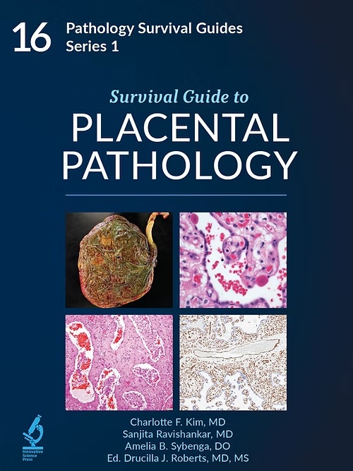Pathology Survival Guides, Series 1Vol.16: Survival Guide to Placental Pathology