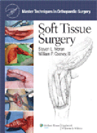Soft Tissue Surgery (Master Techniques in OrthopaedicSurgery)