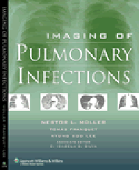 Imaging of Pulmonary Infections