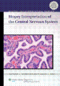 Biopsy Interpretation of the Central Nervous System(Biopsy Interpretation Series)