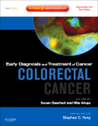 Early Diagnosis & Treatment of Cancer: Colorectal Cancer