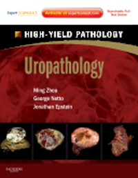 Uropathology(High-Yield Pathology Series)