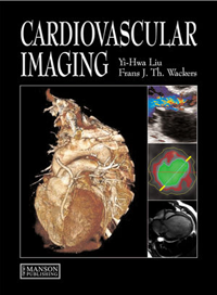Cardiovascular Imaging, Hardcover