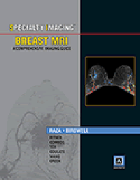 Breast MRI- A Comprehensive Imaging Guide(Specialty Imaging Series)