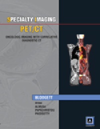 PET/CT-Oncologic Imaging with Correlative Diagnostic CT(Specialty Imaging Series)