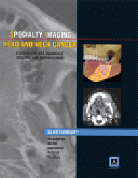 Head & Neck Cancer (Specialty Imaging Series)