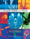 MRI Normal Variants & Pitfall