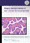Biopsy Interpretation of the Central Nervous System(Biopsy Interpretation Series)