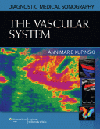Diagnostic Medical Sonography: Vascular System