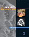 Head & Neck Cancer (Specialty Imaging Series)