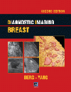 Diagnostic Imaging: Breast, 2nd ed.
