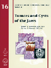 Atlas of Tumor Pathology, 4th Series, Fascicle 16- Tumors & Cysts of the Jaws