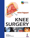 Knee Surgery