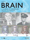 Brain-A Journal of Neurology