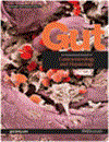 Gut-International J. of Gastroenterology&Hepatology